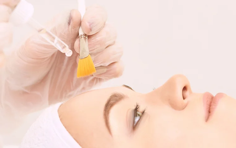 peeling chimico medicina estetica