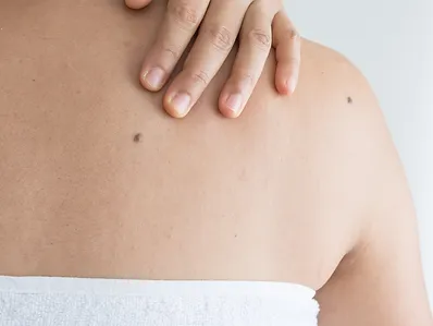 trattamento medicina estetica