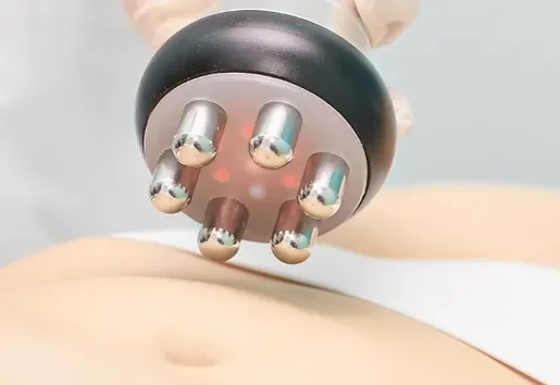 radiofrequenza presso il centro estetico a Lugano