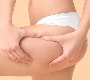 rimozione del grasso localizzato